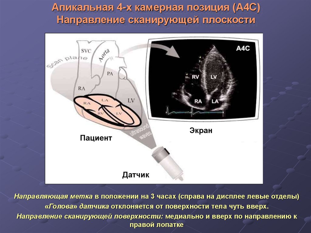 Учебный план эхокардиография