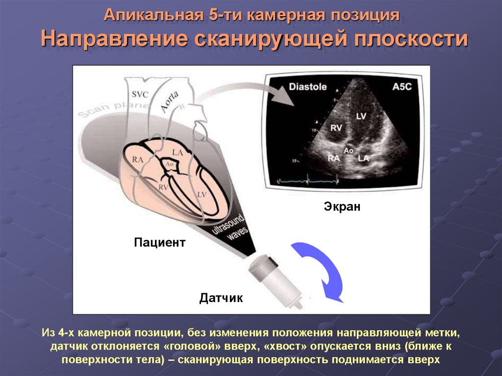 Учебный план эхокардиография