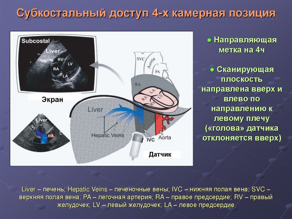 Эхокг в таблицах и схемах рыбакова