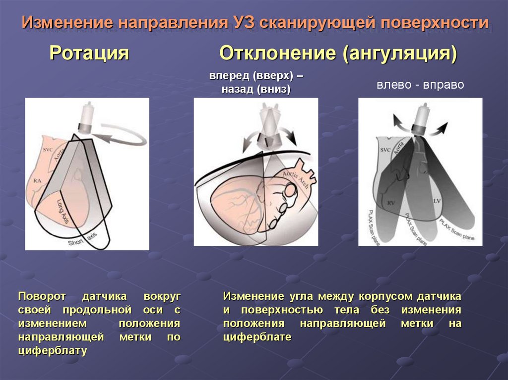 Направленное изменение. Изменение направления. Какие основные плоскости ультразвукового сканирования. Кадр сканирования (поверхности твердого тела):. Плоскости при уз сканировании.