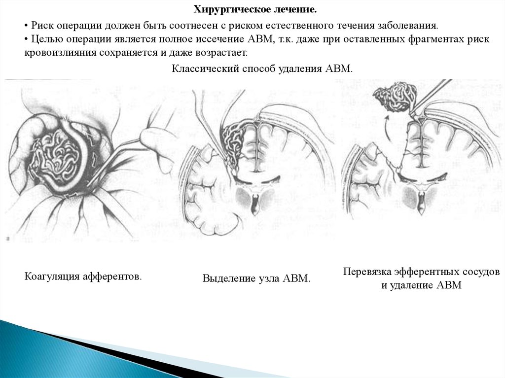 Операция является. Иссечение сосудистой мальформации.