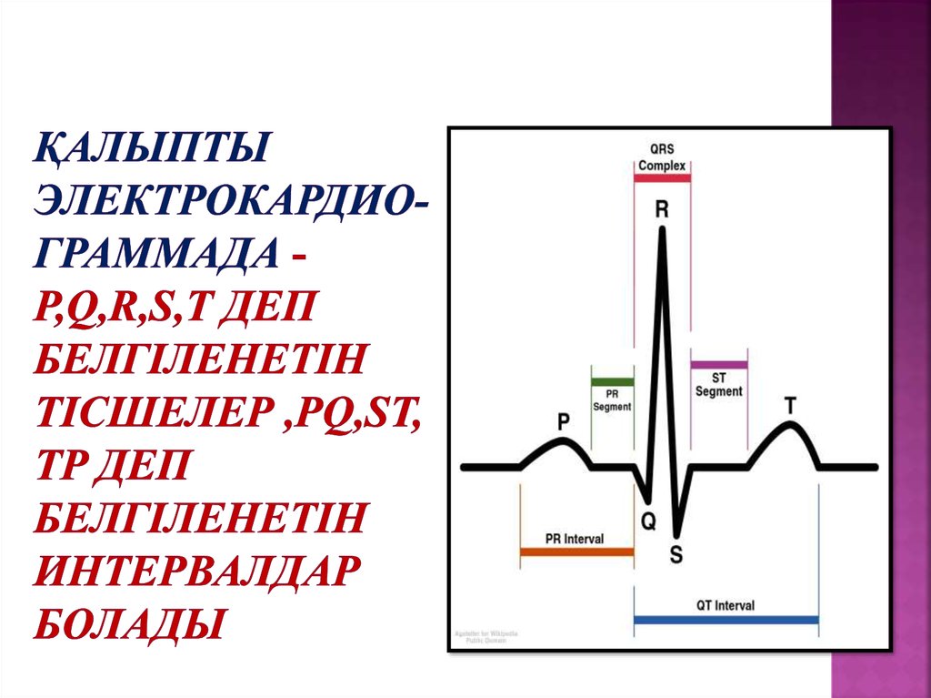 Қалыпты электрокардио-граммада - P,Q,R,S,T деп белгіленетін тісшелер ,PQ,ST, TP деп белгіленетін интервалдар болады