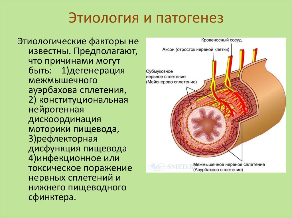 Ахалазия кардии презентация