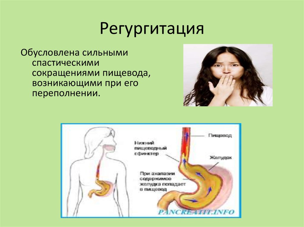 Ахалазия кардии презентация