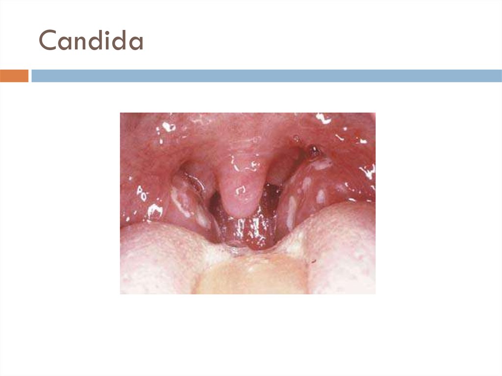 Candida