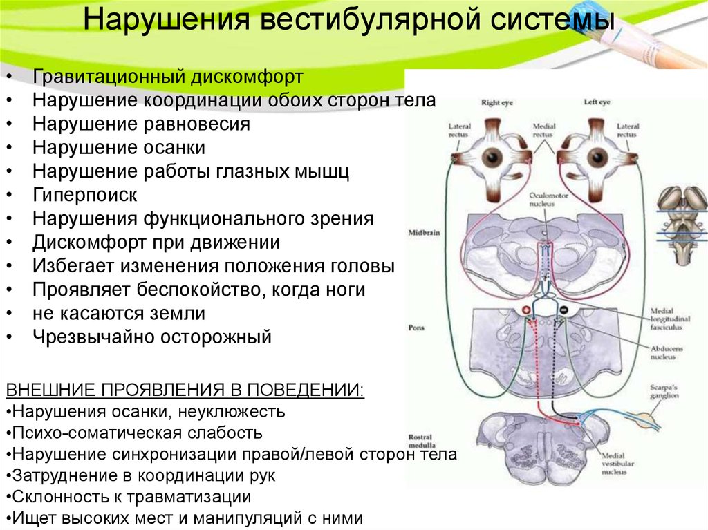 Нарушение работы систем. Нарушение функции вестибулярного аппарата. Расстройство вестибулярного аппарата симптомы. Вестибулярный аппарат нарушения симптомы. Слабый вестибулярный аппарат симптомы.