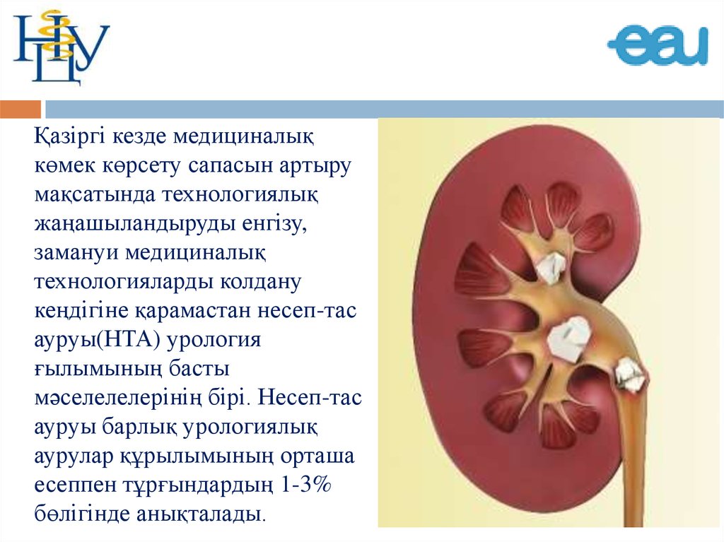 Презентация несеп тас ауруы