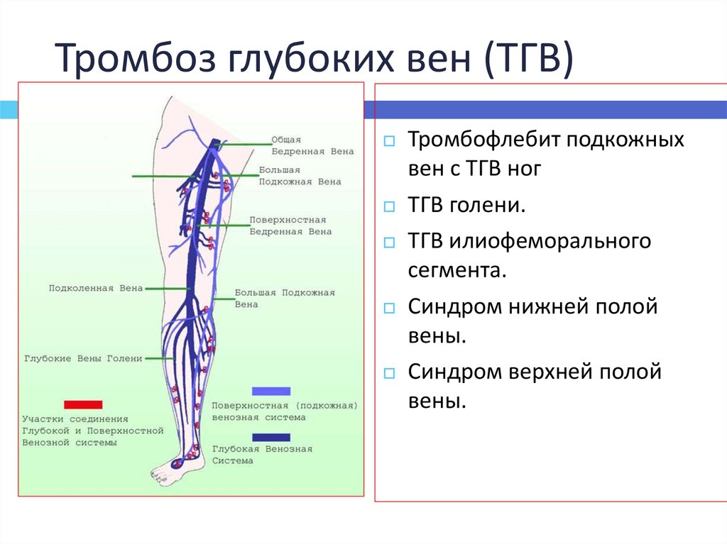 Тромб полых вен. Проксимальный тромбоз глубоких вен. Тромбоз вен нижних конечностей схема. Тэла при тромбозе глубоких вен нижних конечностей. Классификация тромбофлебита поверхностных вен нижних конечностей.