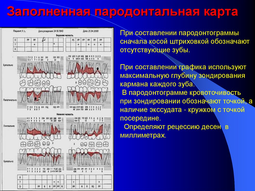 Пародонтограмма. Методы исследования состояния пародонта зубов. Заполнения карт обследования пародонта. Анализ пародонтограммы.