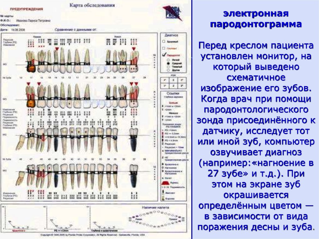 Пародонтограмма. Заполнение пародонтограммы. Пародонтограмма в ортопедической стоматологии. Заполнение пародонтологической карты.