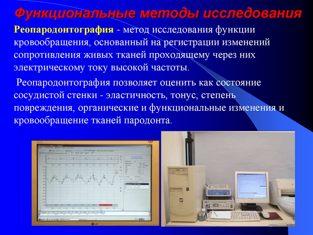 Методы исследования функции. Реопародонтография. Методы исследования состояния пародонта. Реопародонтография в стоматологии. Функциональные методы обследования в стоматологии.