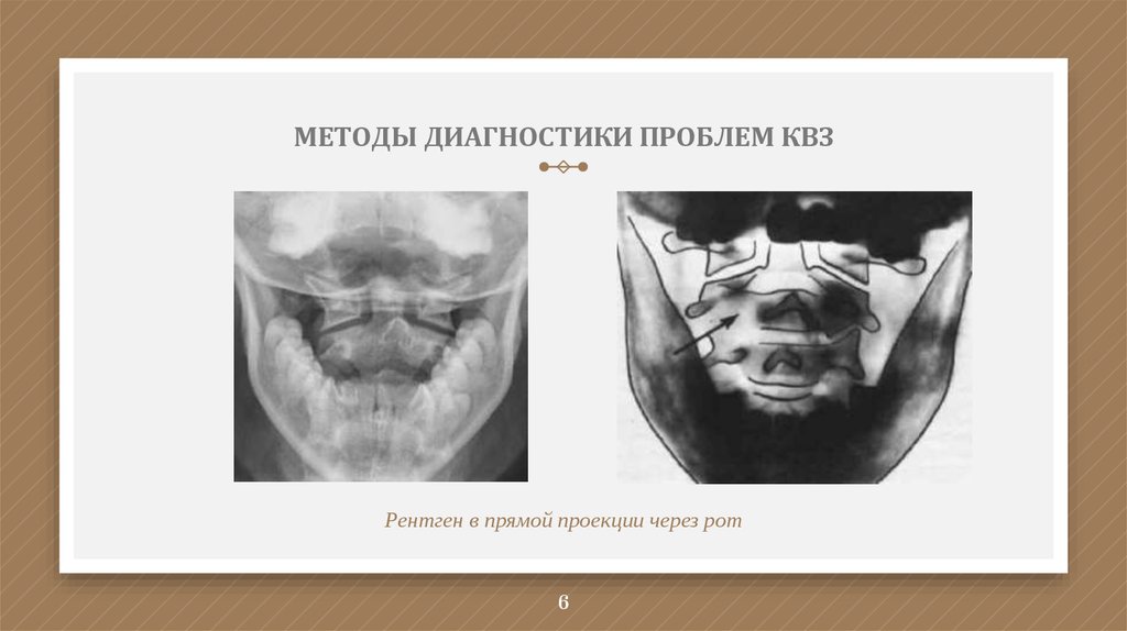 МЕТОДЫ ДИАГНОСТИКИ ПРОБЛЕМ КВЗ
