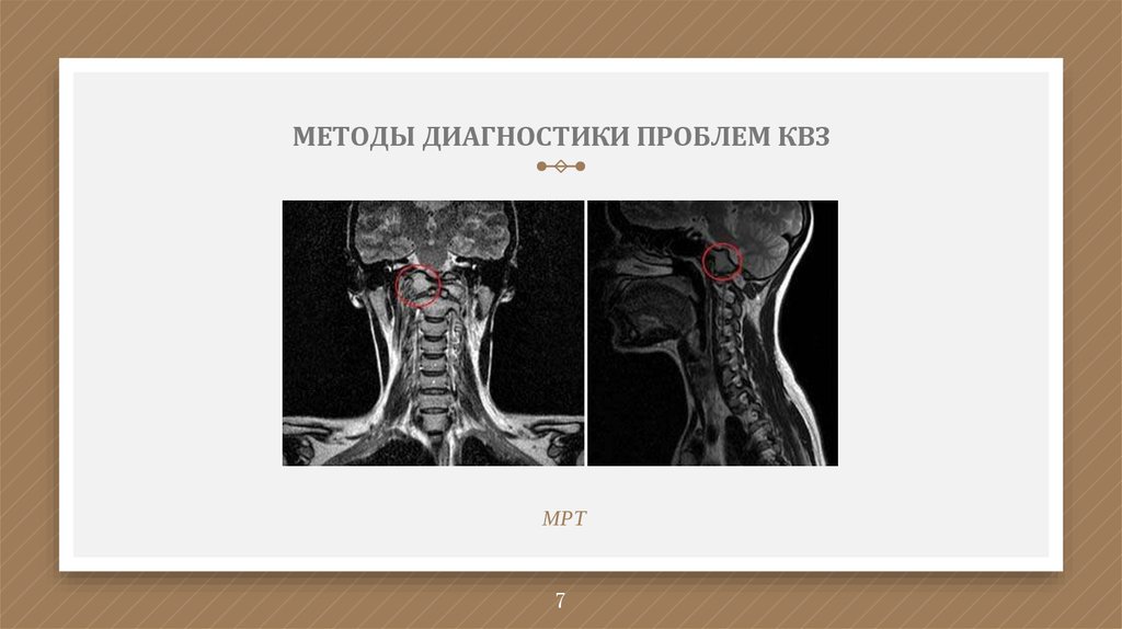 МЕТОДЫ ДИАГНОСТИКИ ПРОБЛЕМ КВЗ