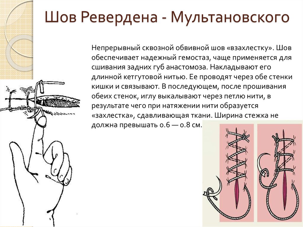 От изображения шва проводят