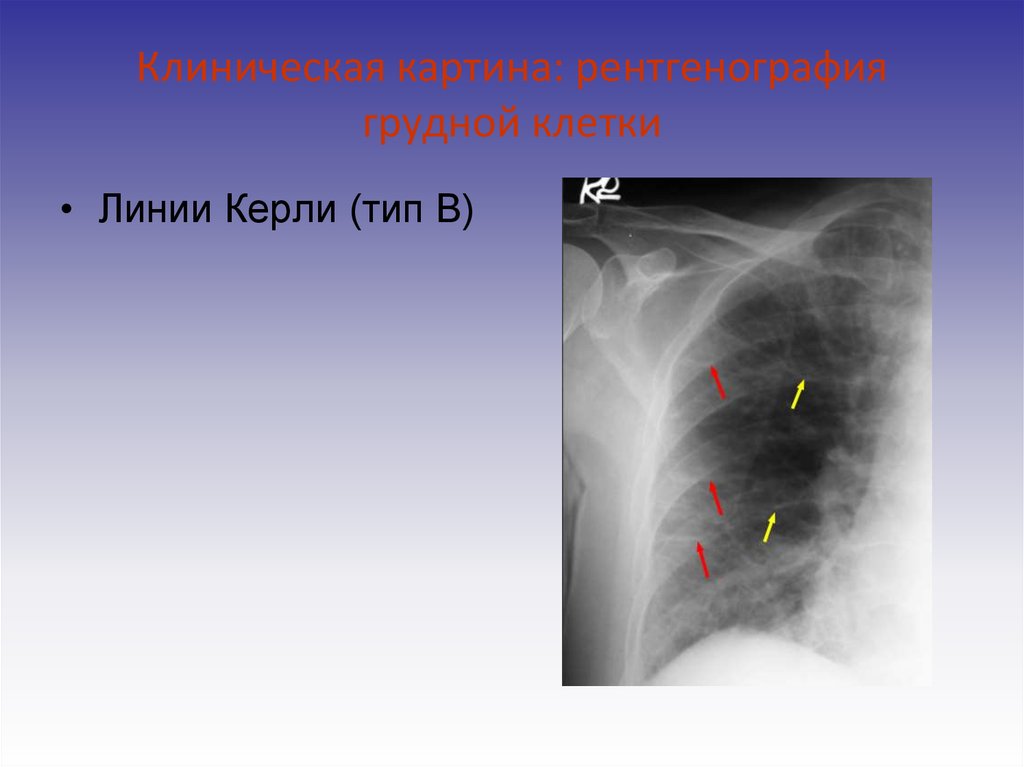 Келлера 1 рентген картина