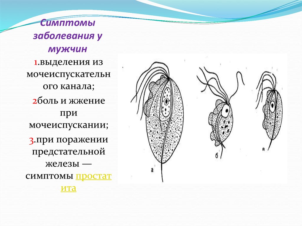 Выделения у мужчин. Что за выделения у мужчин. Выделения при мочеиспускании у мужчин. Легкие выделения у мужчин.