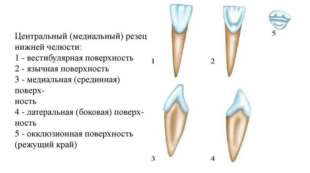 Резцы верхней челюсти