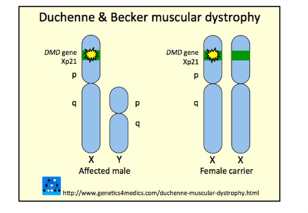 Muscular dystrophy. Мышечная дистрофия Дюшенна ген. Мышечная дистрофия Дюшенна хромосомы. Ген DMD.