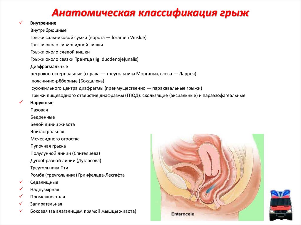 Ректоцеле по утвержденным клиническим рекомендациям. Анатомическая классификация вентральных грыж. Наружные брюшные грыжи классификация. Инцизионная грыжа классификация. Классификация пупочных грыж по размерам.