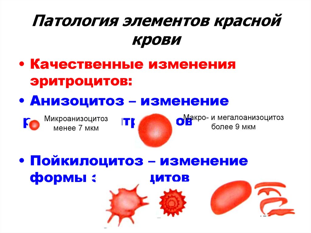 Изменение клеток крови. Форму патологии клеток системы крови. Форма патологии клеток эритроцитов. Патологические формы эритроцитов периферической крови. Изменения красной крови.