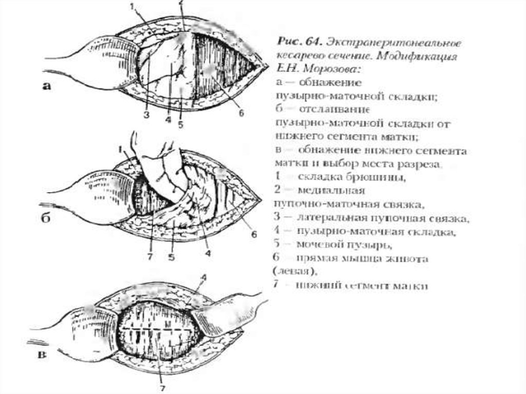 Кесарево сечение у коров презентация