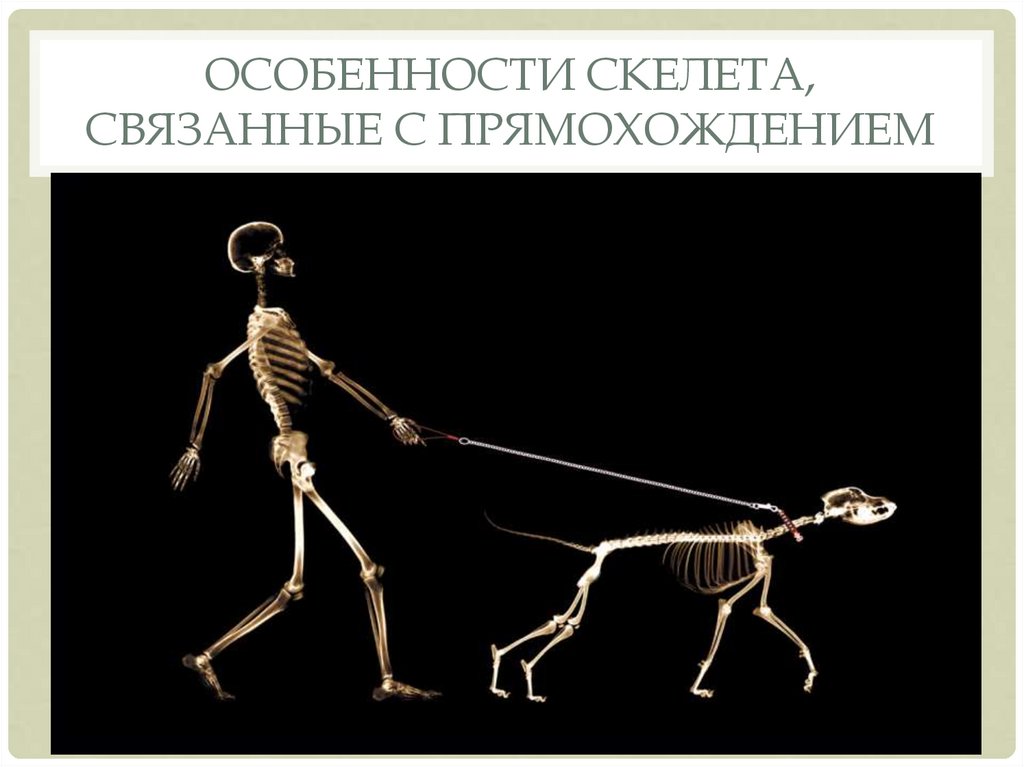 Строение позвоночника современного человека связанный с прямохождением. Особенности скелета. Прямохождение скелет. Особенности скелета, связанные. Особенности скелета связанные с прямохождением.