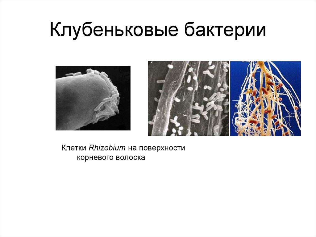 Клубеньковые бактерии значение. Клубеньковые молочнокислые бактерии. Клубеньковые бактерии ризобиум. Клубеньковые бактерии строение. Клубеньковые азотфиксирующие бактерии.
