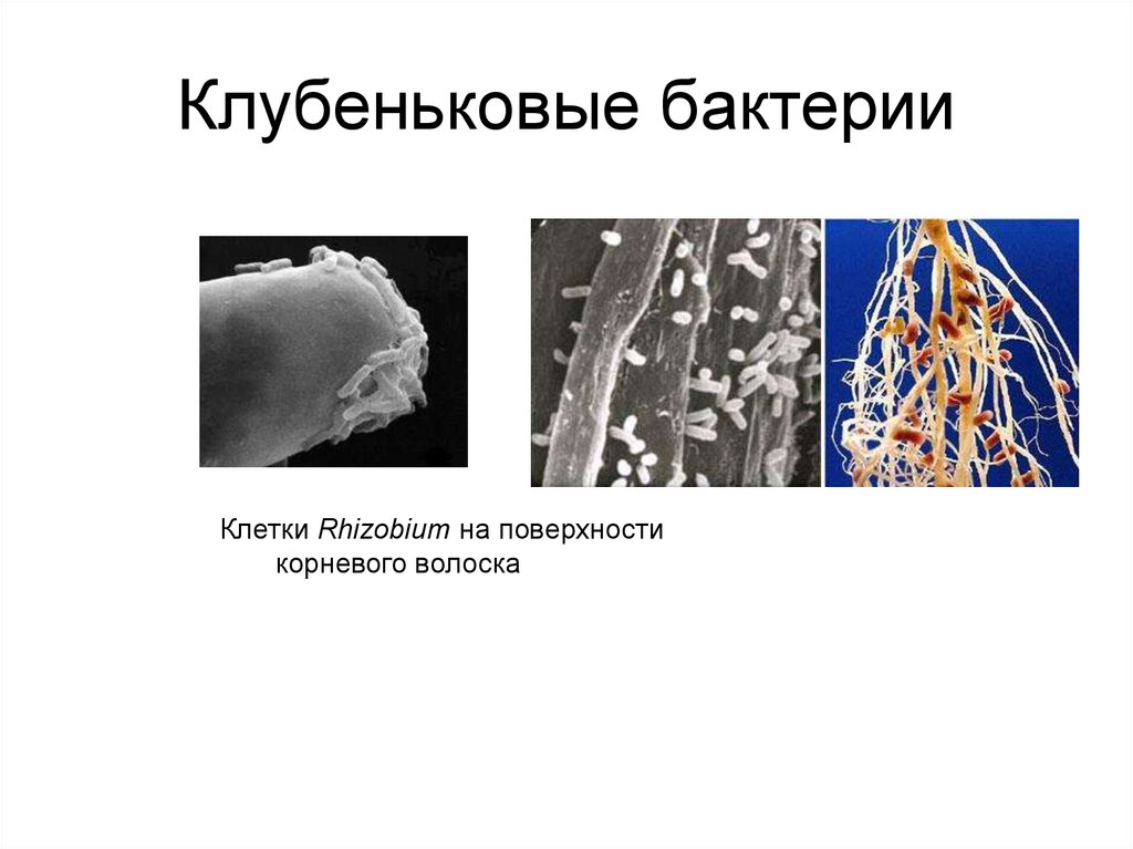 Клубеньковые бактерии. Клубеньковые бактерии Тип питания. Симбиоз микроорганизмов. Клубеньковые бактерии бактерии. Клубеньковые бактерии ризобиум.