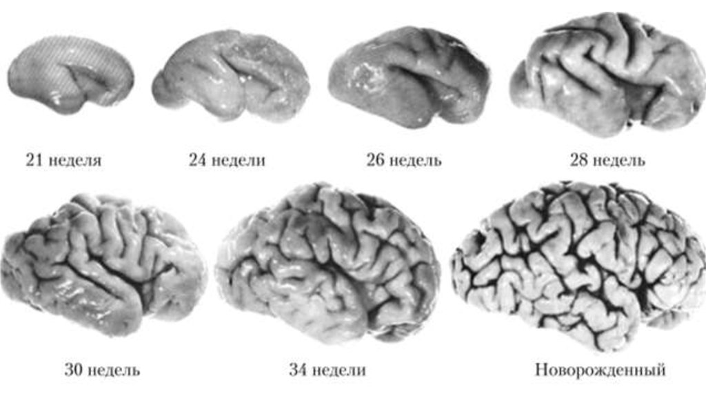Мозг новорожденного масса. Этапы развития коры головного мозга. Развитие коры больших полушарий головного мозга. Этапы развития коры больших полушарий головного мозга в онтогенезе..