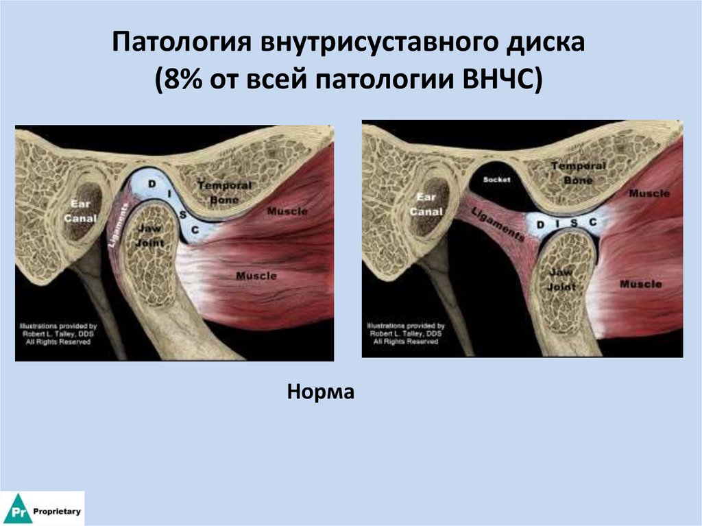 Вентральная дислокация