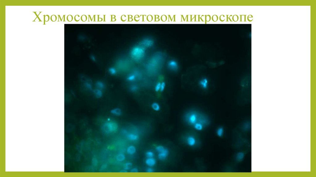 Хромосомы в световом микроскопе