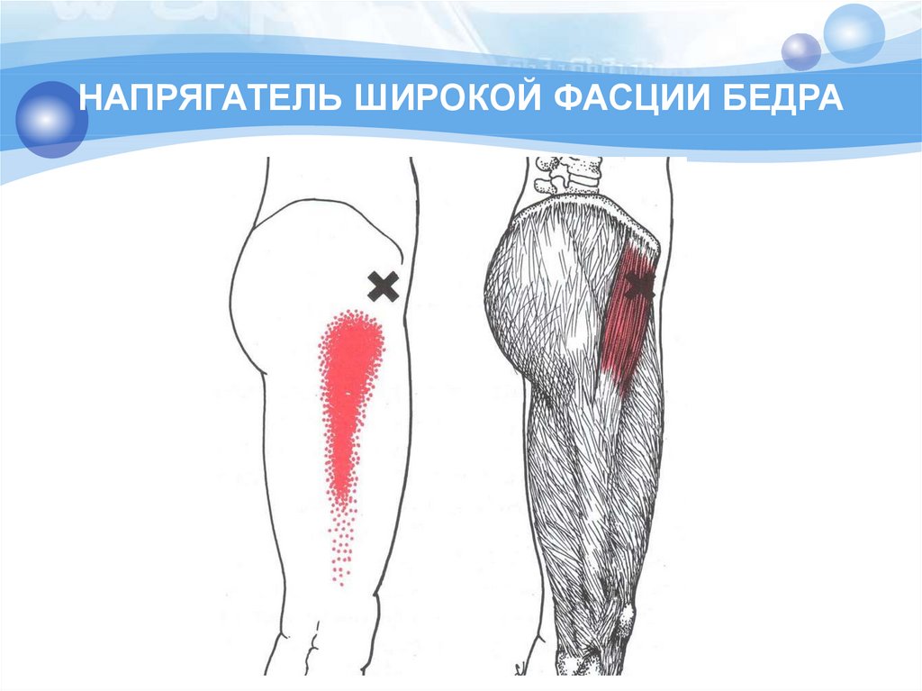 Фасции бедра. Мускул напрягающей широкую фасцию бедра. Напрягатель широкой фасции бедра. Мышца напрягающая широкую фасцию бедра. Широкая фасция бедра анатомия крепление.