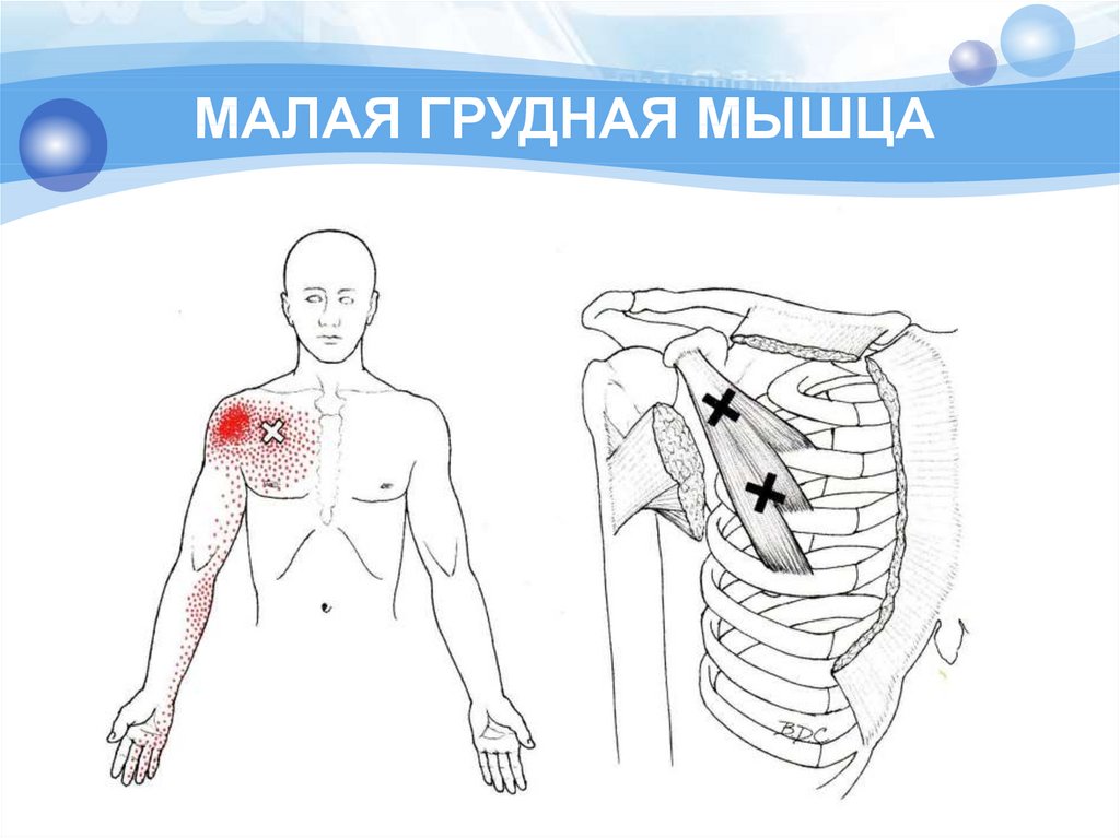 Малая грудная мышца меньше