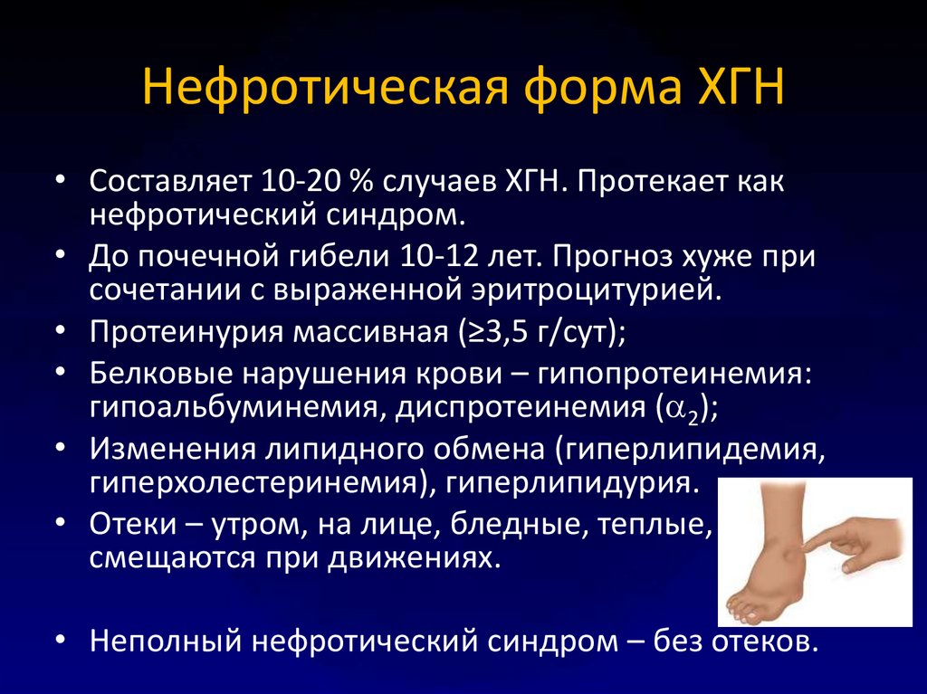 Нефротический криз презентация