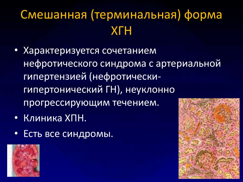 План обследования при остром гломерулонефрите