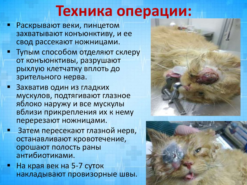 Техника операции: