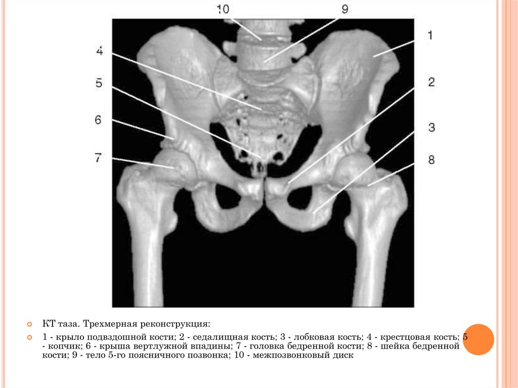 Подвздошной кости 2. Седалищная кость рентген анатомия. Подвздошная кость таза анатомия. Подвздошная кость рентген анатомия. Кости таза анатомия рентген.