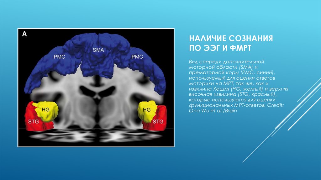 Функциональная мрт презентация