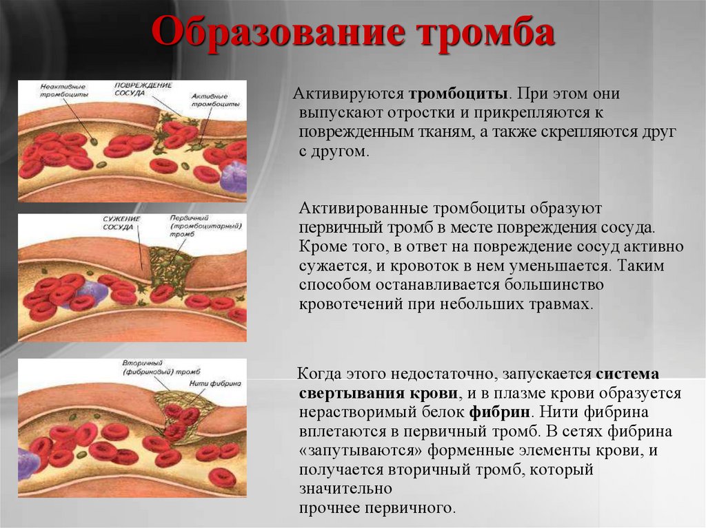 Схема образования кровяного сгустка