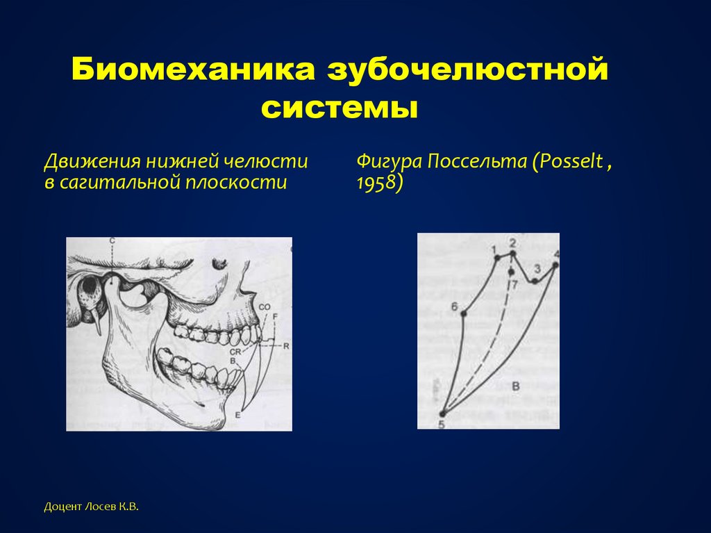 Биомеханика ортодонтия презентация