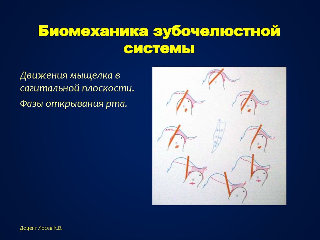 Биомеханика в ортодонтии презентация