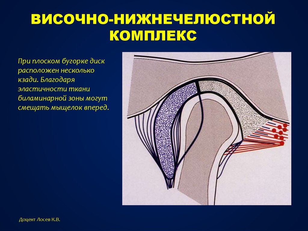 Височно нижнечелюстной сустав анатомия. Биламинарная зона ВНЧС. Биламинарная зона ВНЧС анатомия. Зона сустава височно-нижнечелюстного. Биламинарная зона височно-нижнечелюстного.