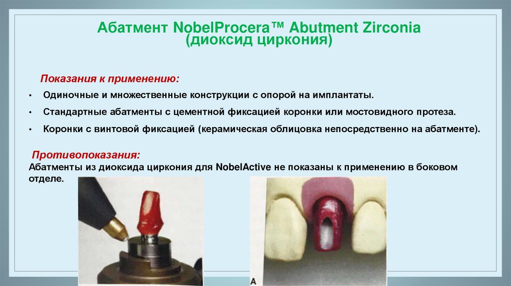 Презентация ортопедия коронки