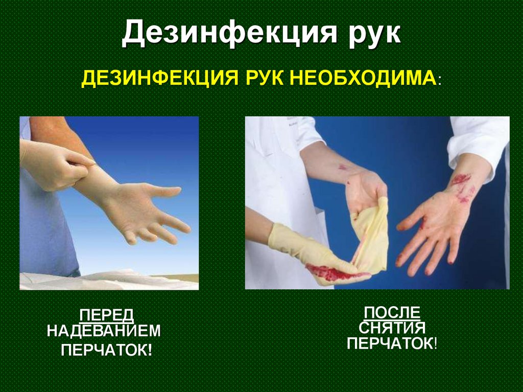 Дезинфекция рук