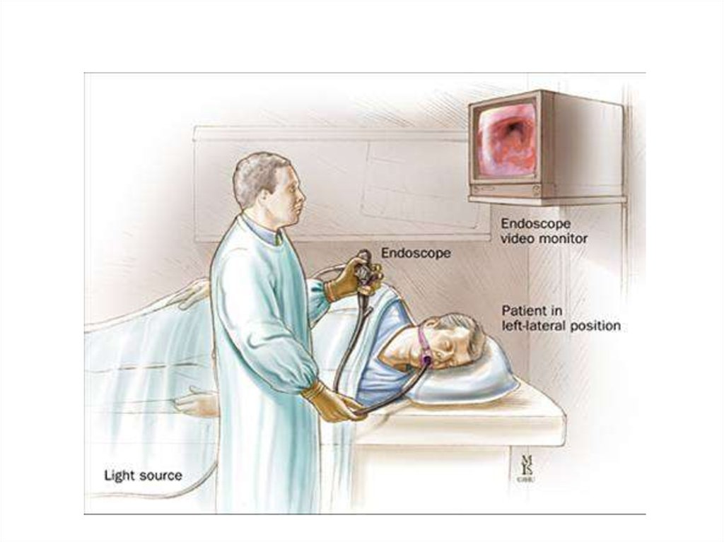 Гастроскопия сколько длится по времени. ФГДС положение пациента. Положение пациента при ф.э.г.д.с.. Эндоскопическое исследование желудка.