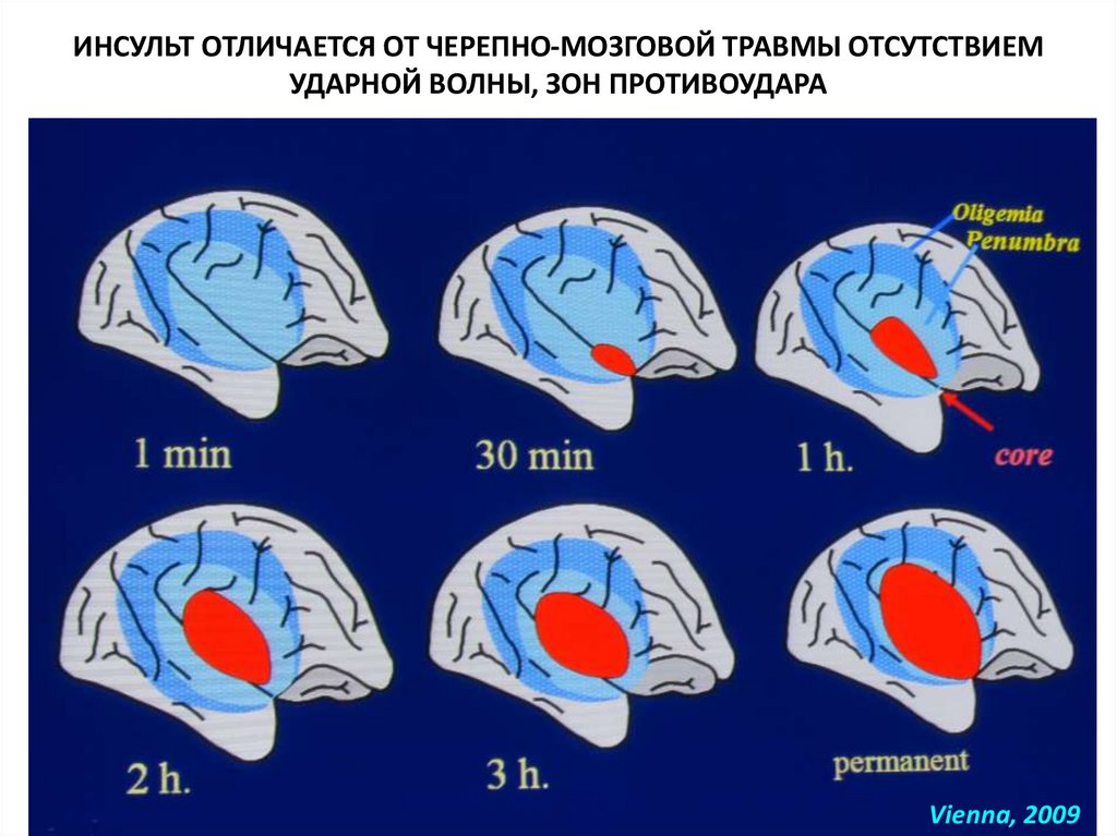 Внутричерепная травма карта вызова