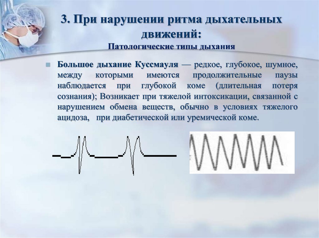 Система ритм. Типы нарушения ритма дыхания. Нарушения ритма и глубины дыхания. Ритм дыхания. Изменение частоты и ритма дыхания.