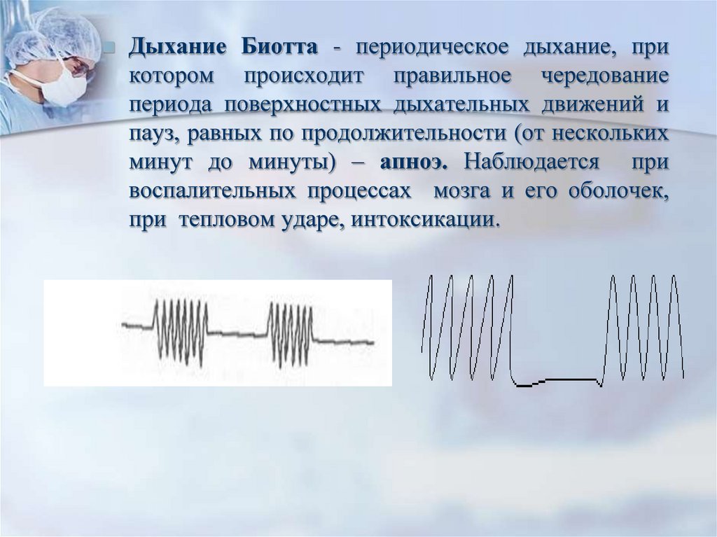 Некоторую минуту. Периодическое дыхание. Процесс периодического прерывания дыхания. Периодическое дыхание возникает при. Виды дыхания соответствующие периодическому дыханию.