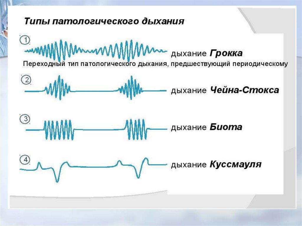 Дышать вид. Дыхание Биота Чейна Стокса Куссмауля. Патологические типы дыхания (чейн-Стокса, Биота, Грокко, Куссмауля). Дыхание Грокка чейн-Стокса Биота Куссмауля это. Патологический Тип дыхания Чейна-Стокса.