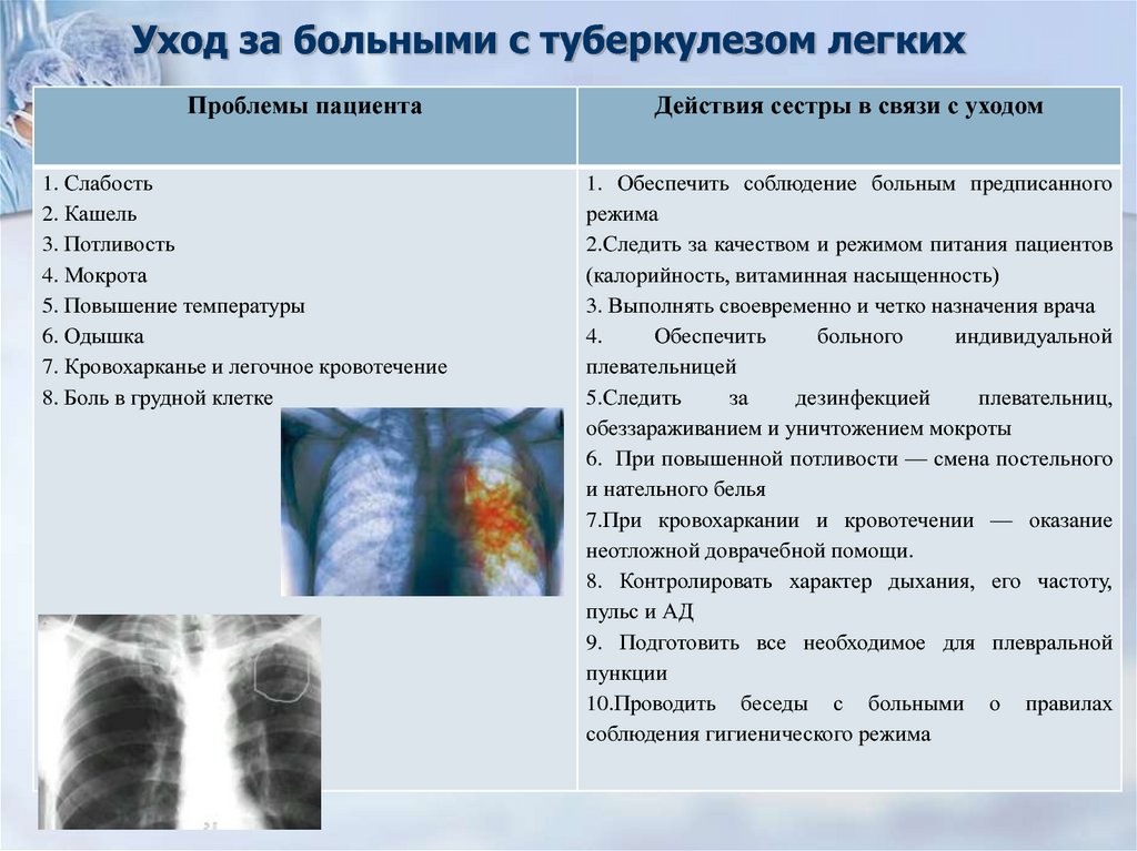 Уход за больными с заболеваниями органов дыхания